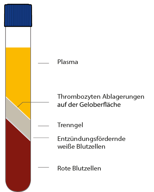 BCT Tube Grafik