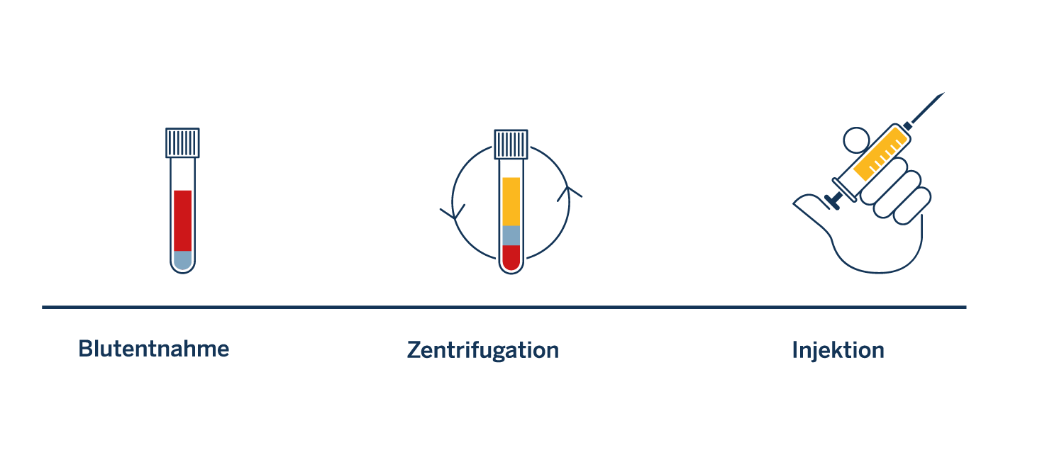 Ablauf_PRP_Behandlung_update